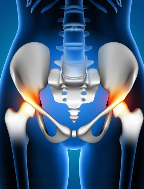 tratamiento-de-pinzamiento-vertebral-en-leon-guanajuato.jpg