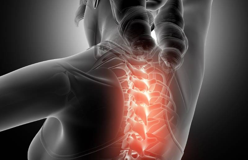 Atención a la mielopatía cervical ofrecida por el Dr. Erick Maldonado Pérez