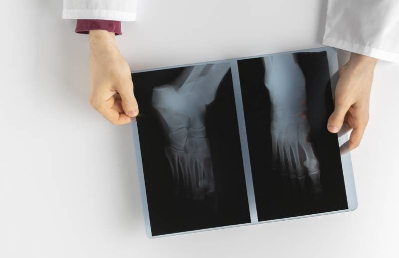 Trauma de urgencia ofrecido por Dr. Erick Maldonado Pérez - Especialista en Ortopedia y Traumatología